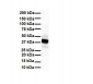 SLC6A5 Antibody - N-terminal region